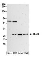 Detection of human and mouse TECR by wes