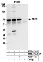 Detection of human TFEB by western blot 