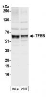 Detection of human TFEB by western blot.