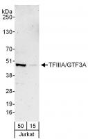 Detection of human TFIIIA/GTF3A by weste