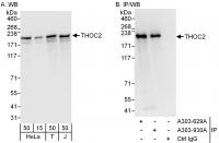 Detection of human THOC2 by western blot
