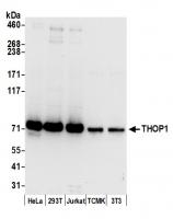Detection of human and mouse THOP1 by we