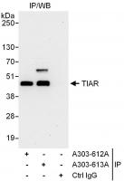 Detection of human TIAR by western blot 