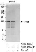Detection of human TKS4 by western blot 