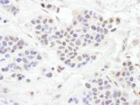 Detection of human TLE1 by immunohistoch