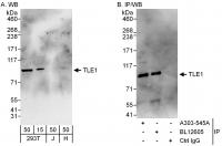 Detection of human TLE1 by western blot 