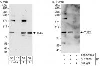 Detection of human TLE2 by western blot 