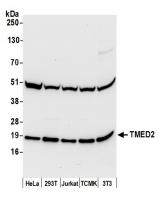 Detection of human and mouse TMED2 by we