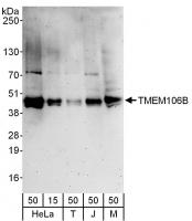 Detection of human and mouse TMEM106B by