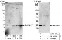 Detection of human and mouse TMEM127 by 