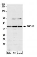 Detection of human TMOD3 by western blot