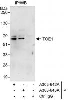Detection of human TOE1 by western blot 