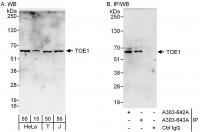 Detection of human TOE1 by western blot 