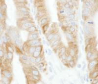 Detection of human TRAF2 by immunohistoc