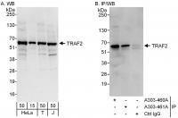 Detection of human TRAF2 by western blot
