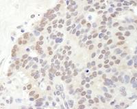 Detection of human TRPS1 by immunohistoc