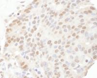 Detection of human TRPS1 by immunohistoc