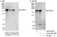 Detection of human TRPS1 by western blot