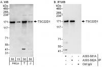 Detection of human TSC22D1 by western bl
