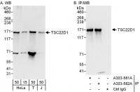 Detection of human TSC22D1 by western bl