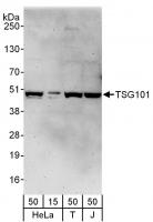 Detection of human TSG101 by western blo