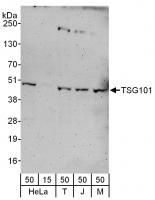 Detection of human and mouse TSG101 by w