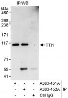 Detection of human TTI1 by western blot 