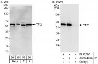 Detection of human TTI2 by western blot 