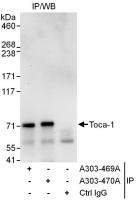 Detection of human Toca-1 by western blo