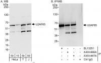 Detection of human U2AF65 by western blo
