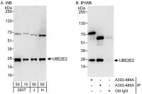 Detection of human UBE2E2 by western blo