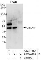 Detection of human UBXN1 by western blot
