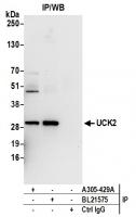 Detection of human UCK2 by western blot 