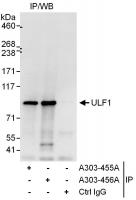 Detection of human ULF1 by western blot 