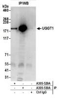 Detection of human UGGT1 by western blot
