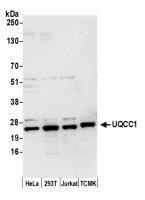 Detection of human and mouse UQCC1 by we