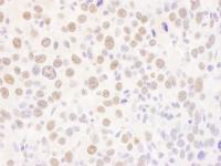 Detection of mouse USF2 by immunohistoch