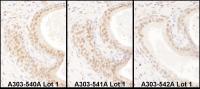 Detection of human USF2 by immunohistoch