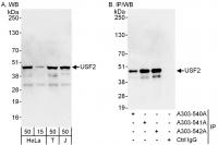 Detection of human USF2 by western blot 