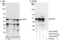 Detection of human USF2 by western blot 