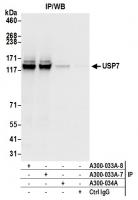 Detection of human USP7 by western blot 