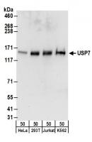 Detection of human USP7 by western blot.