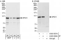 Detection of human VPS11 by western blot