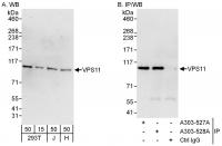 Detection of human VPS11 by western blot