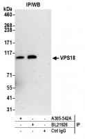 Detection of human VPS18 by western blot