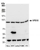 Detection of human and mouse VPS18 by we