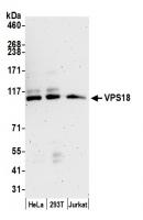 Detection of human VPS18 by western blot