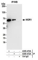 Detection of human WDR1 by western blot 
