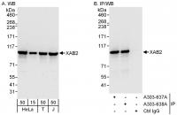 Detection of human XAB2 by western blot 