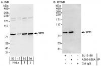 Detection of human XPD by western blot a